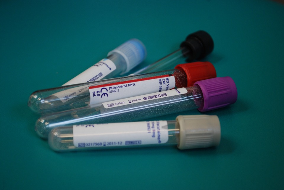 lab test tubes