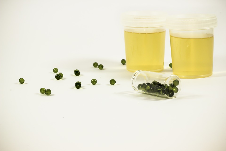 urine test